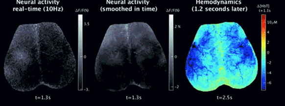 Calcium fluorescence & hemodynamics capturing brain activity.